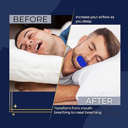 SleepSure Mouth Tape